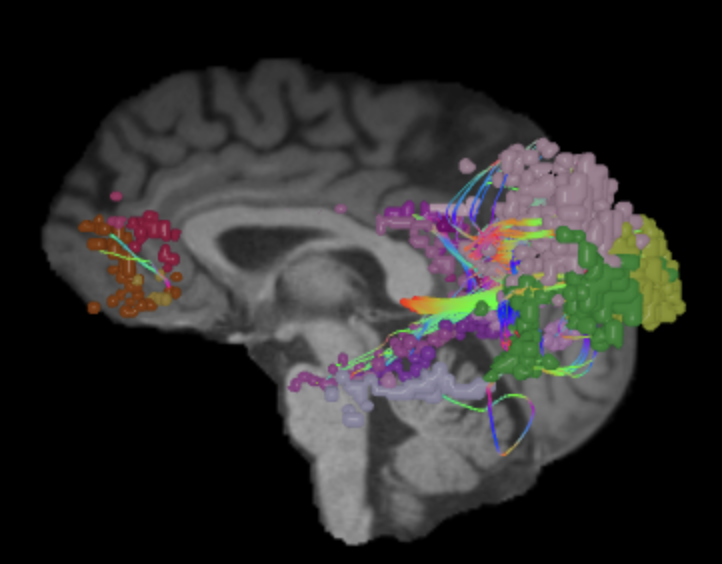 Default Mode Network Connectome Guide